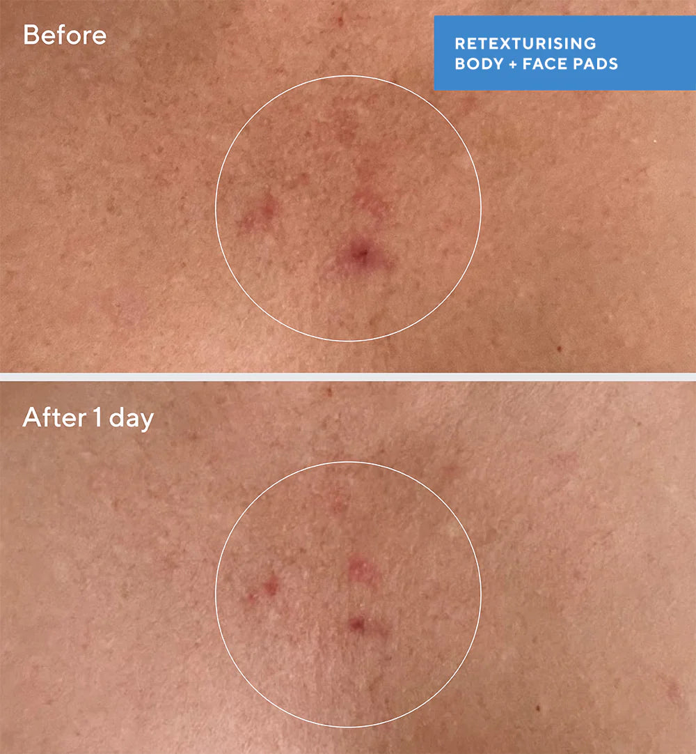 Murad Retexturising Body + Face Pads