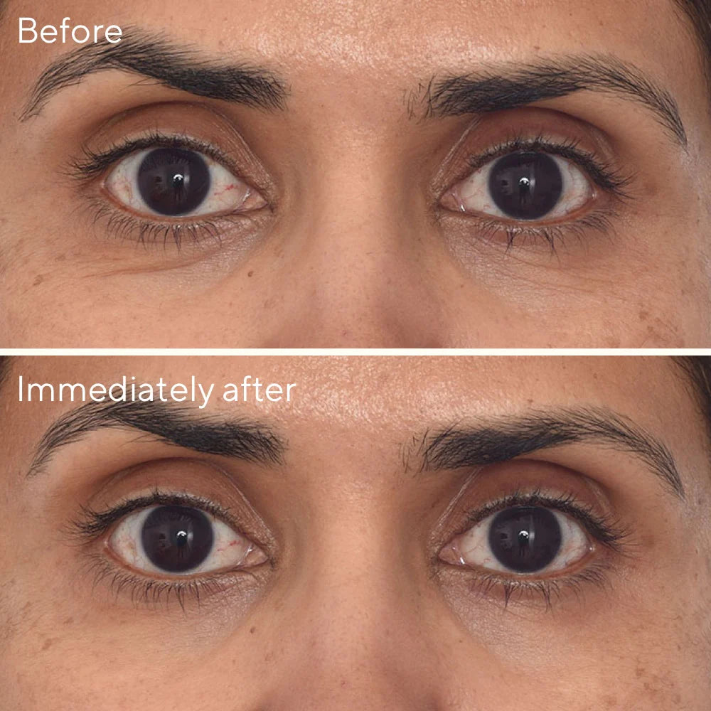 Murad Retinol Youth Renewal Eye Masks